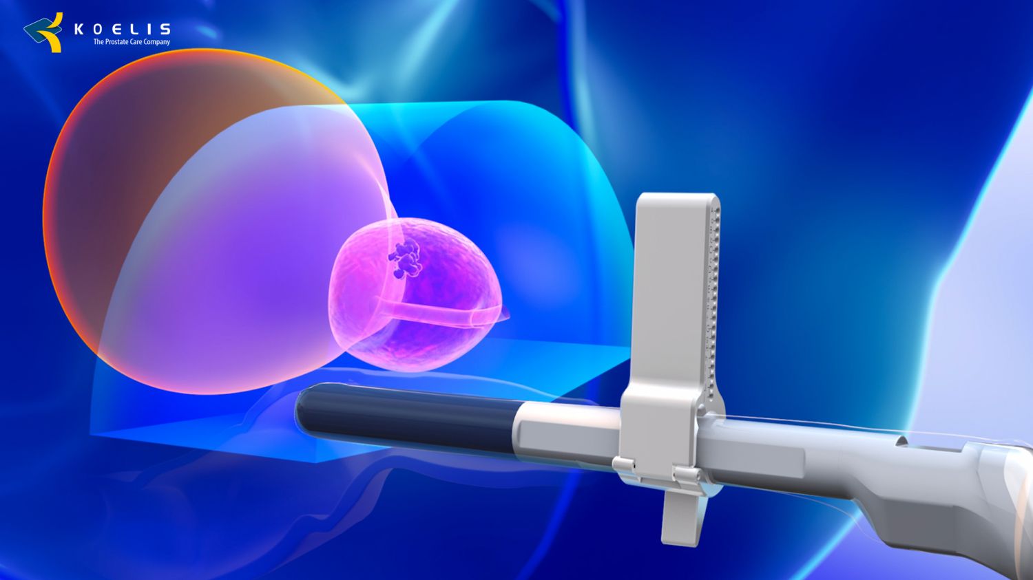 BIOPSJA FUZYJNA PROSTATY